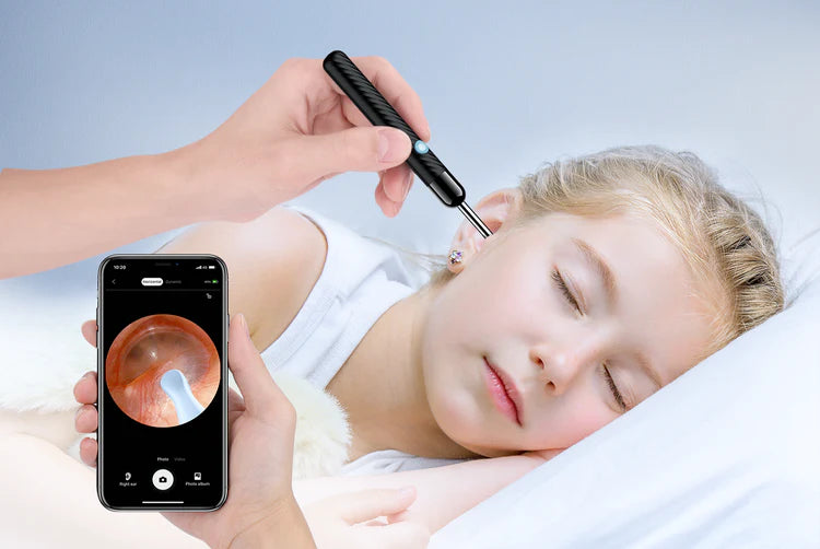 AudixPro™ Earwax Removal Kit