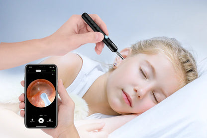 AudixPro™ Earwax Removal Kit